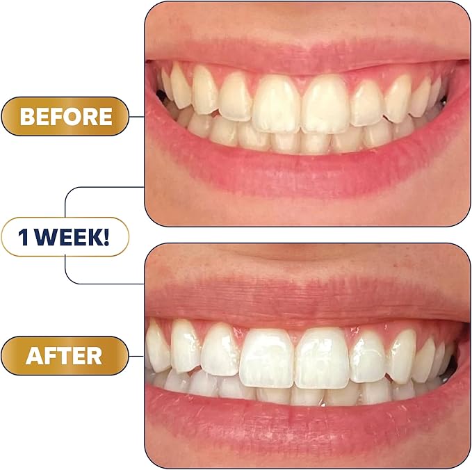 Lumineux Teeth Whitening Strips - 35 Treatments (6 Months) – Peroxide Free - Enamel Safe for Whiter Teeth - Whitening Without The Sensitivity - Dentist Formulated - Sensitivity Free